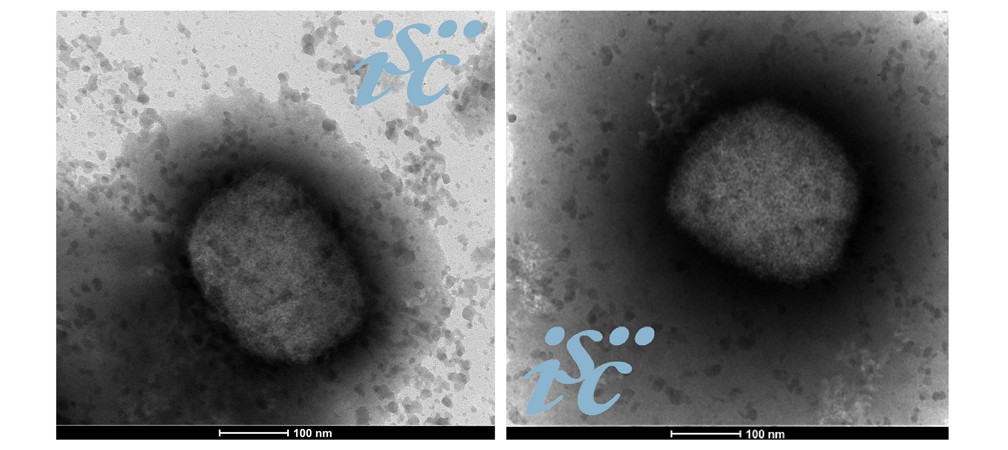 Imagen del virus mPox obtenida por microscopía electrónica por la Unidad de Microscopía Electrónica del ISCIII