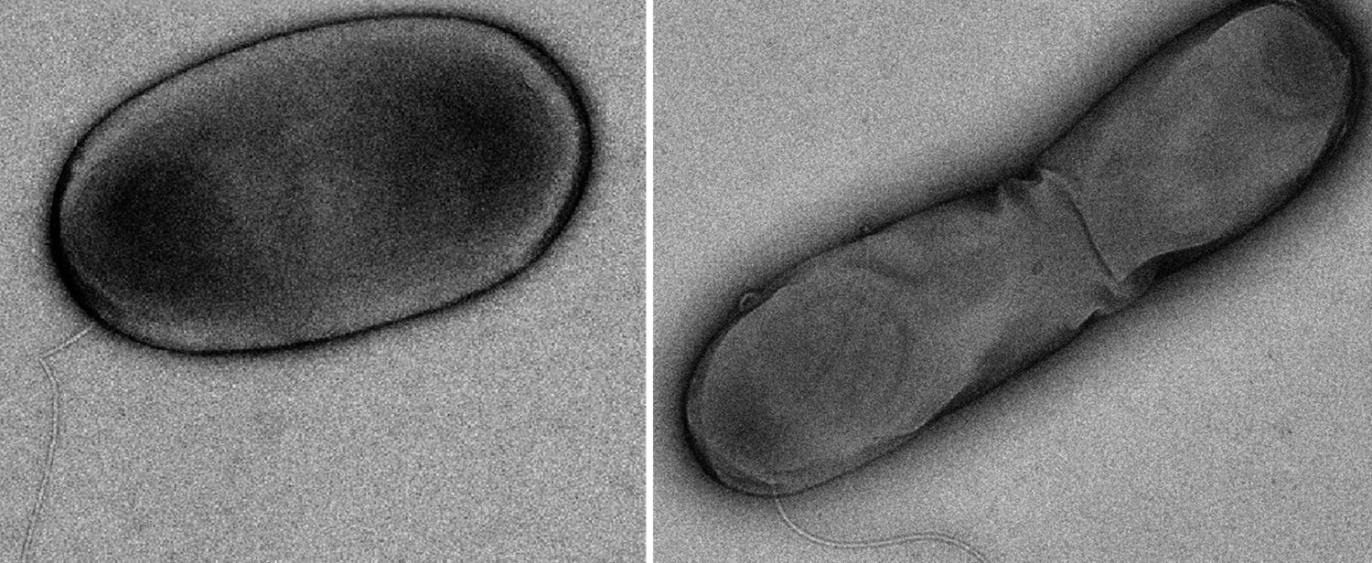 Imagen al microscopio de las dos bacterias, 'bautizadas' como 'Legionella pelazae' y 'Legionella navarrensis'.