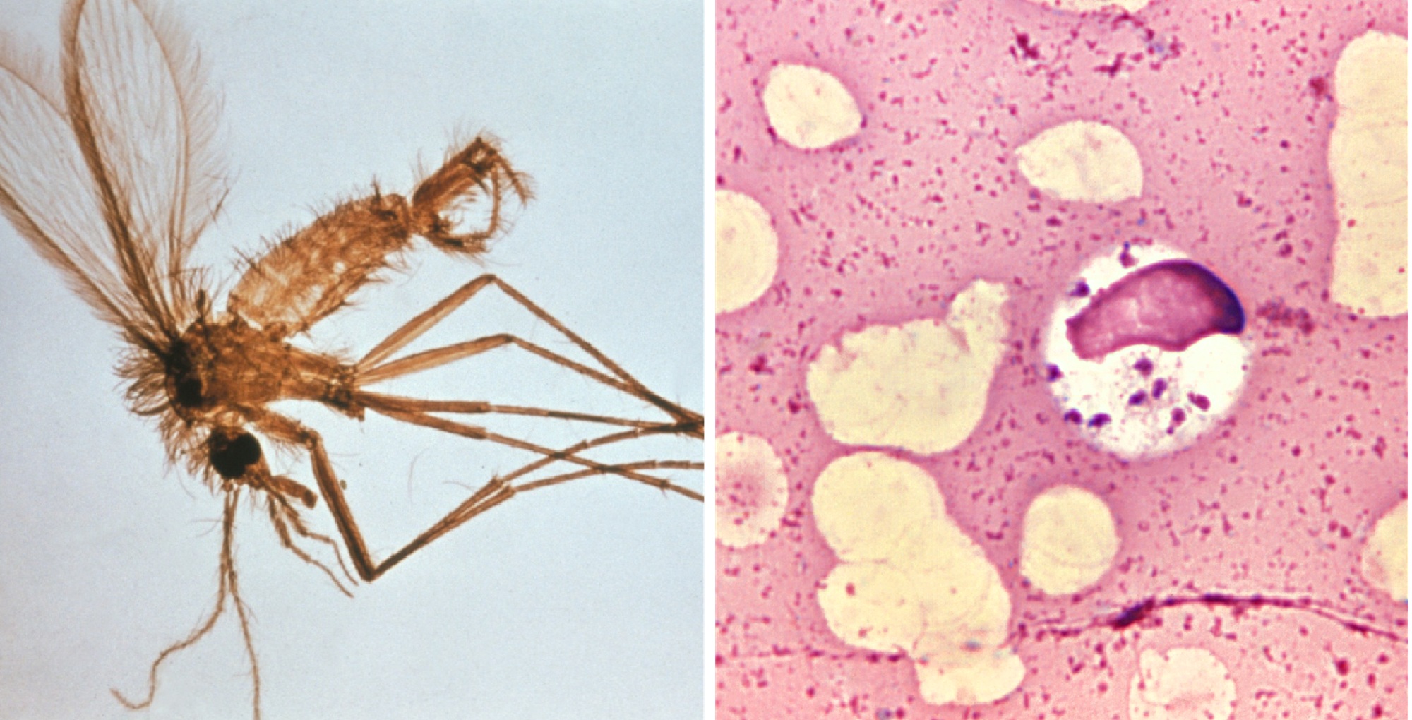 A la izquierda, flebótomo -transmisores de la enfermedad-, y a la derecha, Leishmania visceral en células de médula ósea (imágenes: CDC).