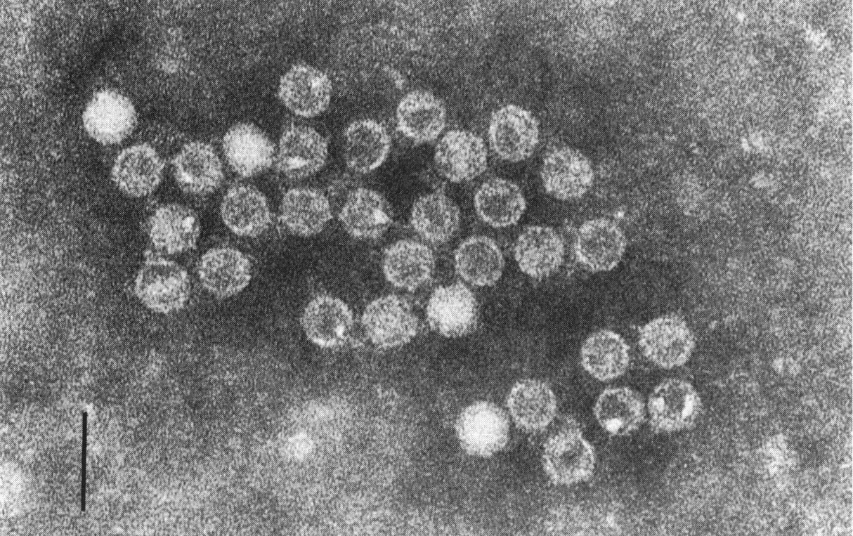 Imagen al microscopio de un echovirus 11, un tipo de enterovirus con algunas características similares al detectado en España en la investigación ahora publicada por un equipo del CNM-ISCIII